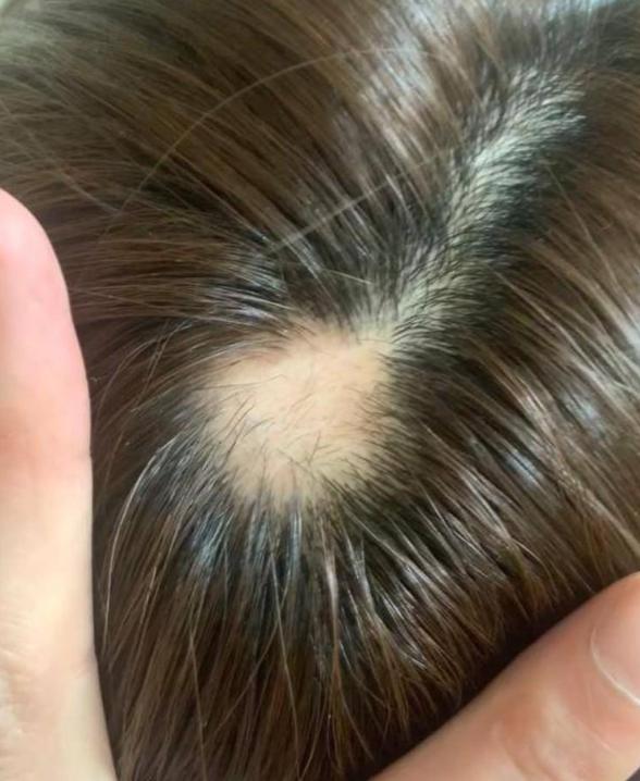 女明星也秃头？杨紫鞠婧祎全靠小心机，杨幂没刘海就是“光明顶”