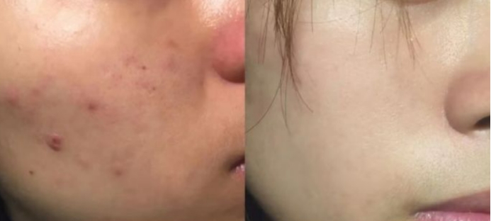 安全温和水乳有哪些牌子,孕妇可以用的水乳平价真实测评