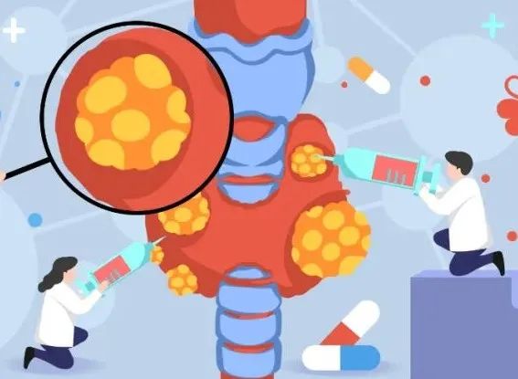 i甲,甲癌全切后复发是什么症状