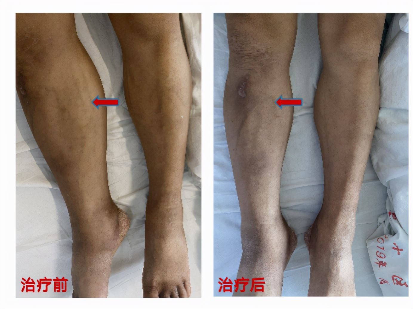 仁心妙术播撒光明,仁心妙术