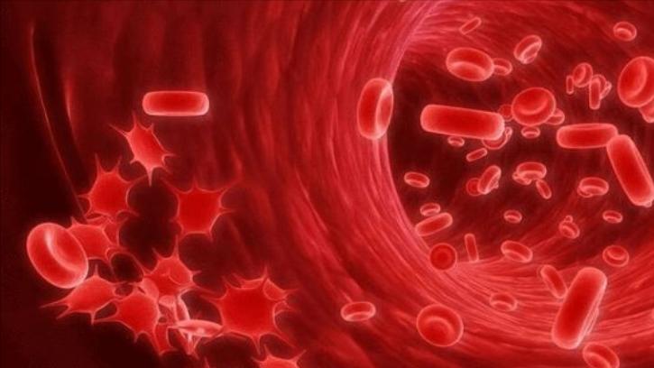 泌尿系统结石是什么原因导致的,泌尿系统结石的症状是什么