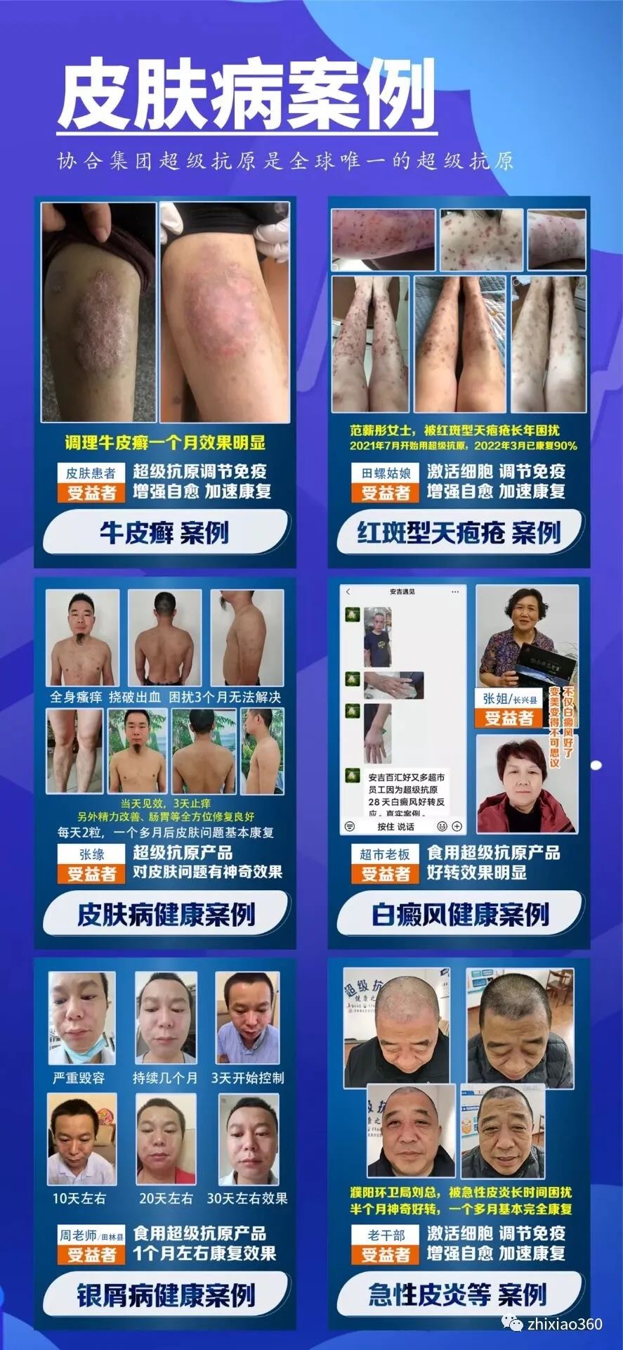 高聚生谦百福多元肽能治百病？其代理制度涉嫌传销