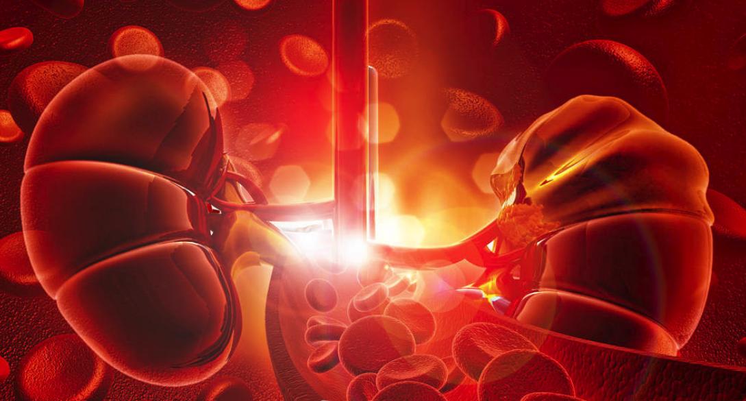 43岁女性肾病诊断,43岁女子双脚浮肿半年