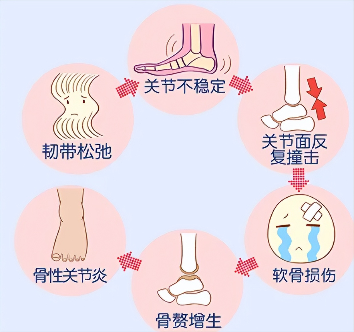 踝关节急性扭伤先冷敷还是热敷,扭伤踝关节应该热敷还是冷敷