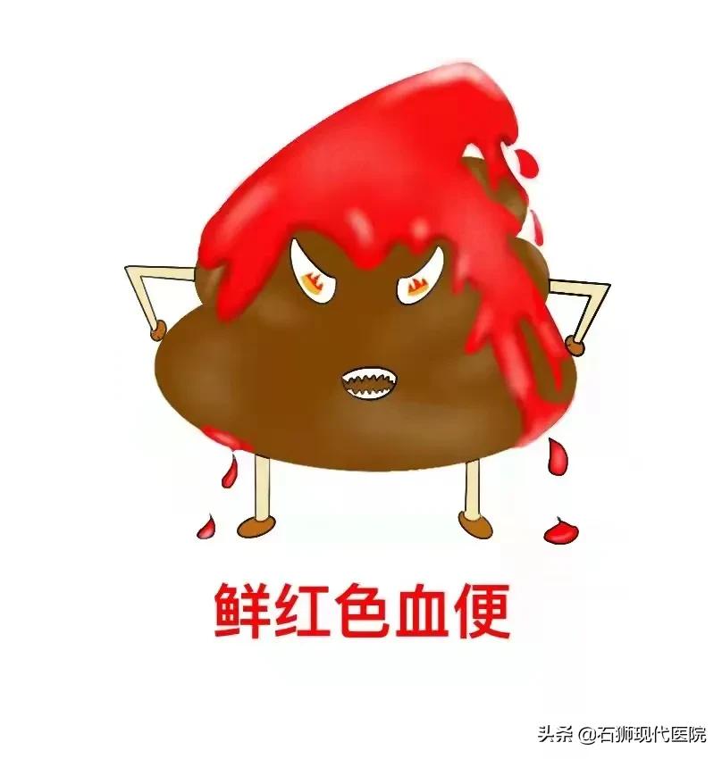 便血挂肛肠外科,便血一般肛肠外科怎么检查