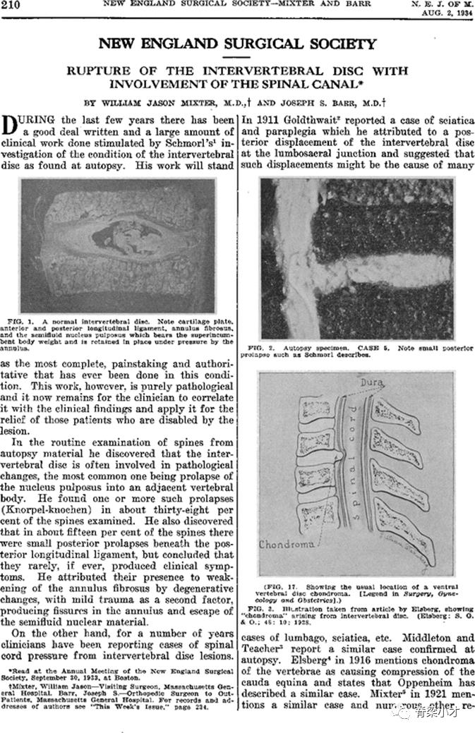 腰椎间盘突出症的诊断与鉴别,腰椎间盘突出和膨出的区别在哪里