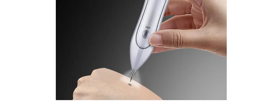 为洗纹身买单,洗纹身有什么代价