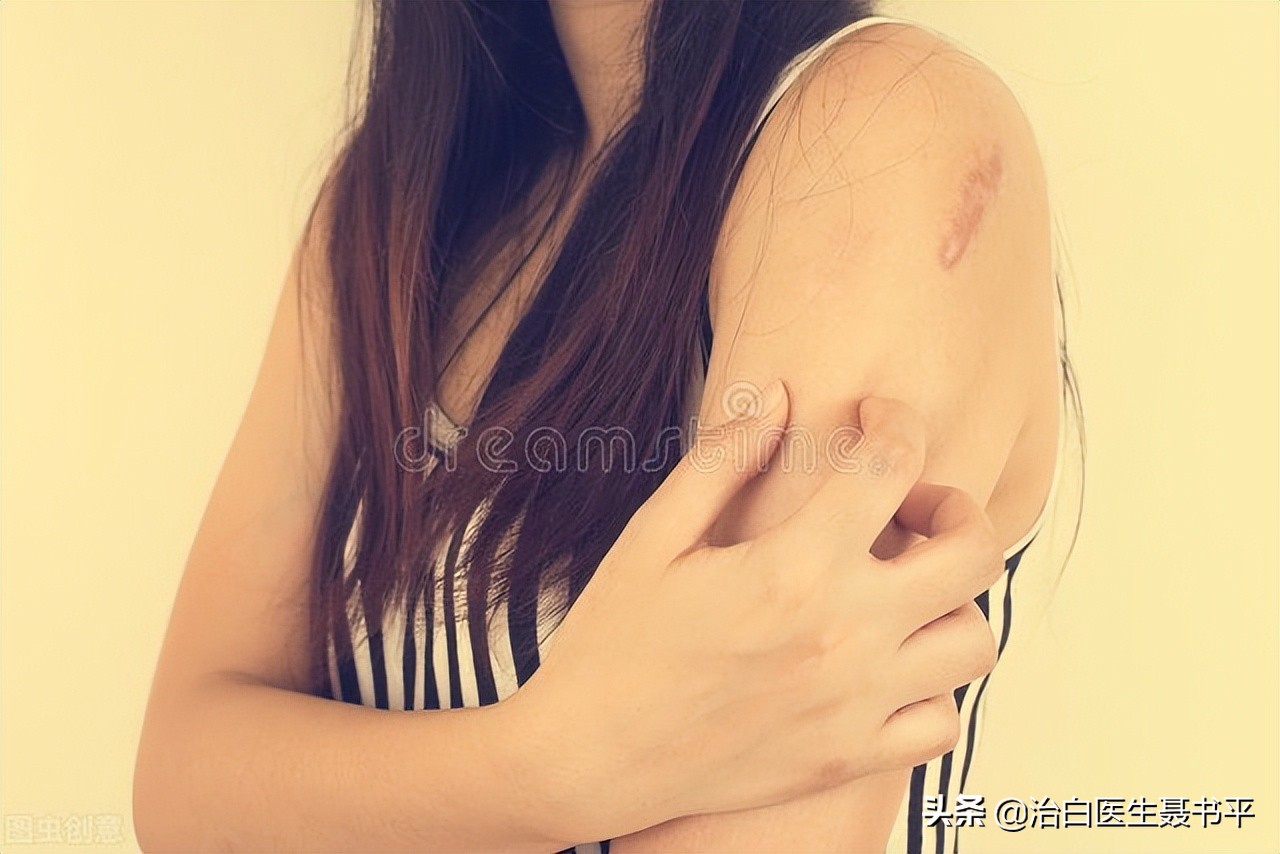 不痛不痒的白斑突然痒了，是我们做错了什么吗？