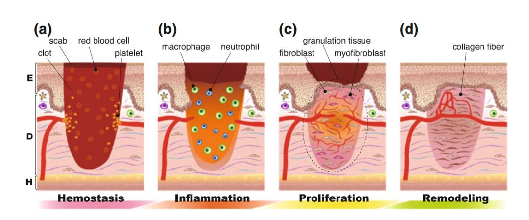 肛周脓肿中医三黄膏,紫草膏可以治肛周脓肿吗