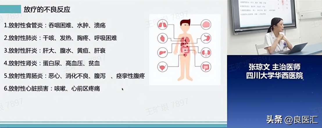 放疗后期反应有哪些症状,放疗后的副作用有哪几种