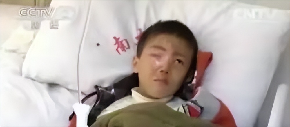 孩子眼球20分钟被熔化,小孩眼珠被熔化了怎么办