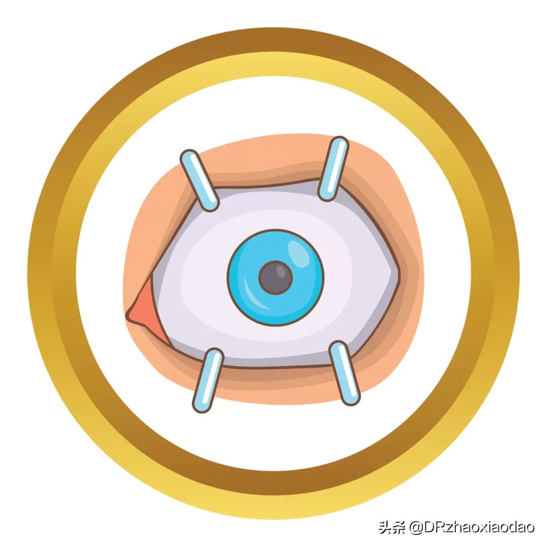 icl植入术技术问题,icd植入适应症指南