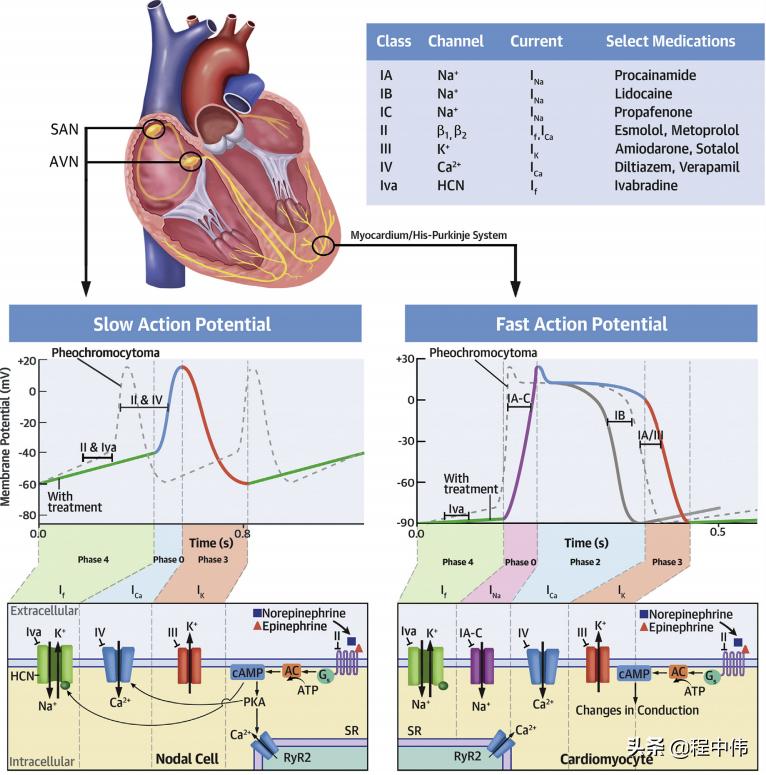 嗜铬细胞瘤出现心慌会长多大,嗜铬细胞瘤心动过速的原因
