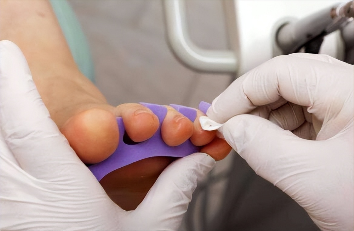 小脚趾指甲两瓣的人是什么来历,小脚趾指甲分两瓣是什么说法