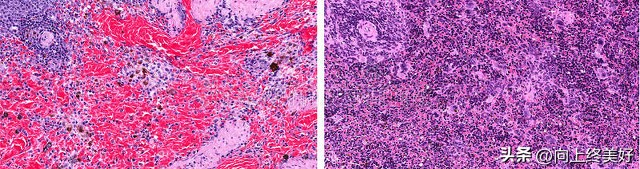 为什么不建议学基础医学,基础医学研究生能当医生吗
