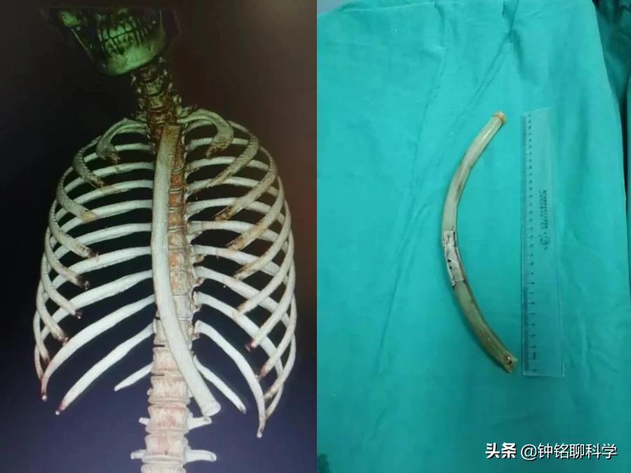 怎样戒掉暴饮暴食和催吐习惯,暴饮暴食催吐怎样戒掉