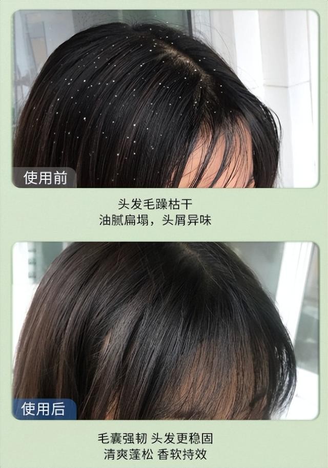 干枯细软头发大牌洗发水推荐,洗发水推荐前十名同款洗发水