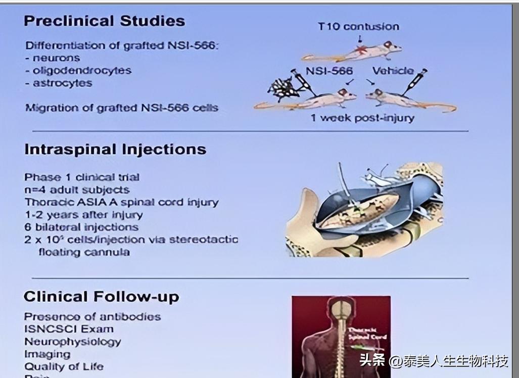 干细胞脊髓损伤治疗图片,干细胞治疗脊髓损伤临床案例
