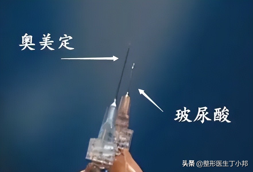 奥美定并发症有哪些,奥美定注射后遗症有哪些