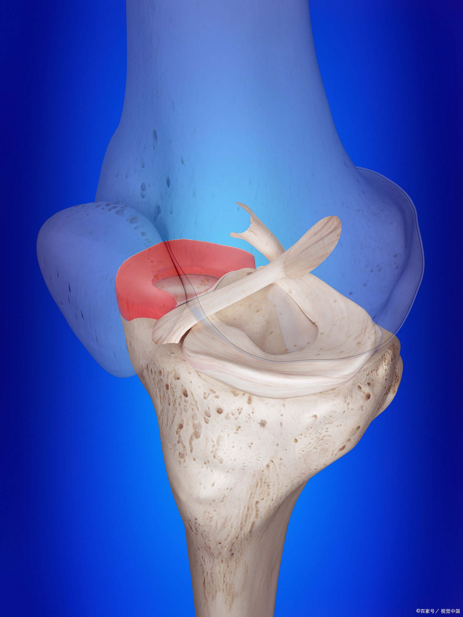 半月板损伤后喝中药要多长时间,半月板损伤中药调理方剂