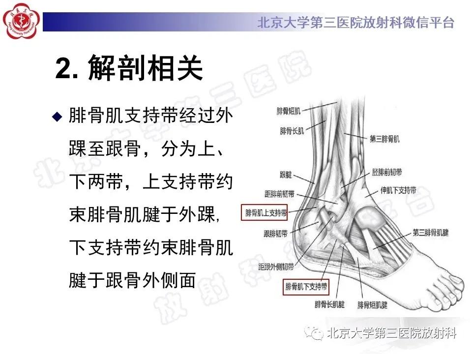 好文分享续集,腓骨肌腱脱位手术价格