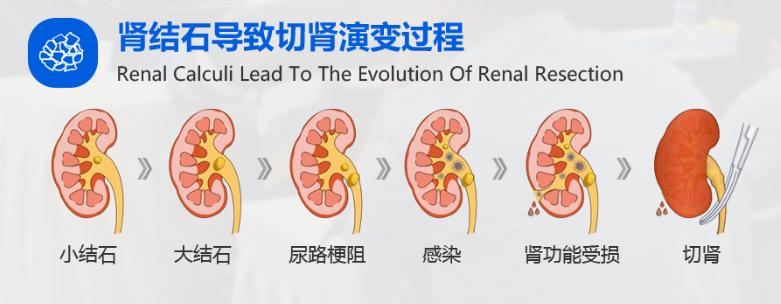 这几种疾病进入高发期,一年12个月高发疾病