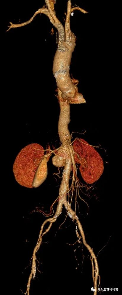 南昌二附院血管外科专家,南昌大学第二附属医院周卫