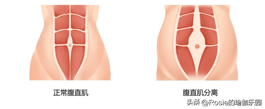 生育损伤合集,生育损伤有哪些