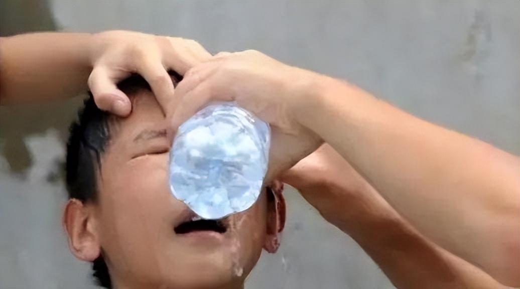 20分钟孩子眼球被融化了,男孩眼睛被融化了