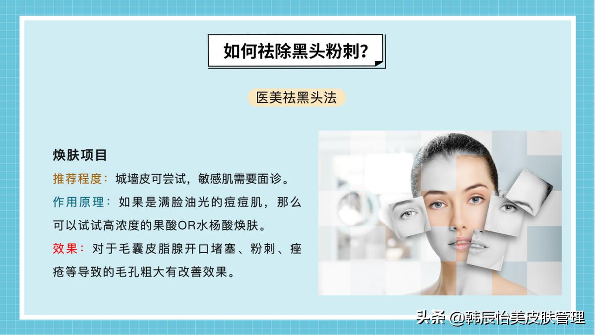 怎么能够彻底的去黑头小妙招,怎么有效的去黑头小妙招