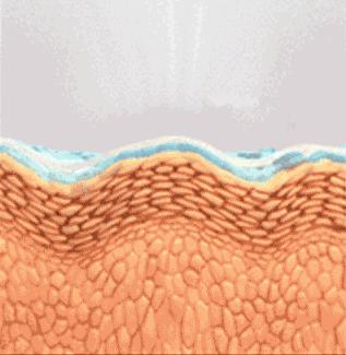 热玛吉后用的提拉面膜,热玛吉以后要医美面膜么