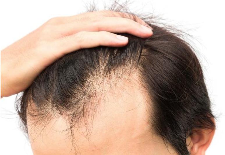 性价比最好生姜防脱洗发水,防脱生姜洗发水推荐修正