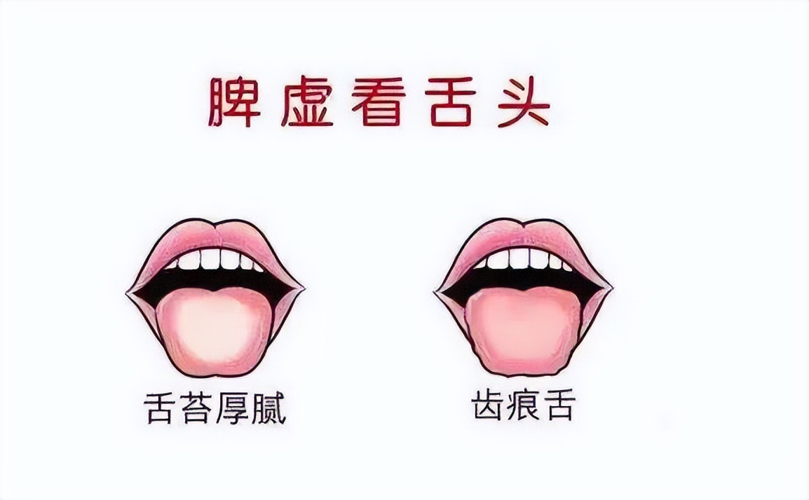 脾胃虚怎么才能彻底治好,胃强脾弱和脾胃虚弱哪个好治疗