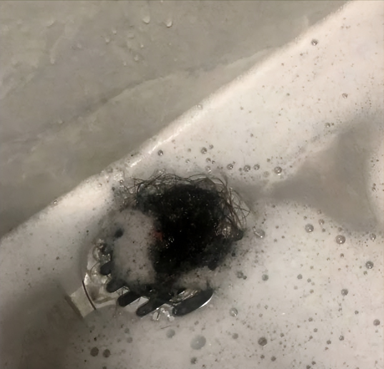 怀孕后用什么洗发露防掉发,怀孕后头发特别油是怎么回事