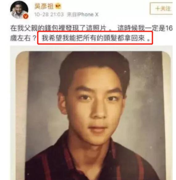 发际线秃的男星,盘点十大秃头男星佩戴假发
