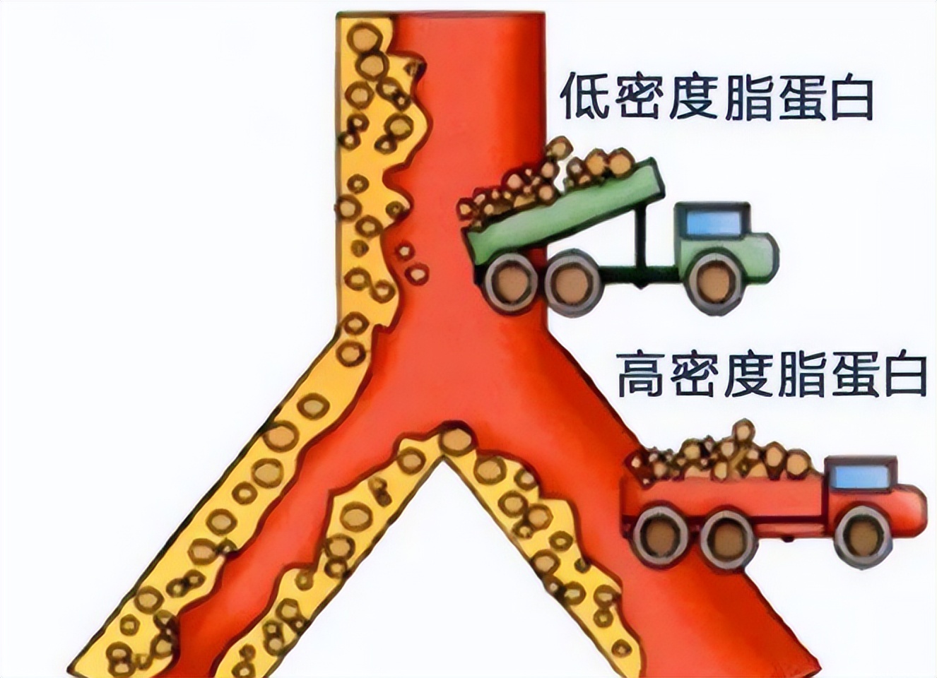 腔隙性脑梗死属于脑血栓么,腔隙性脑梗死属于心脑血管疾病吗