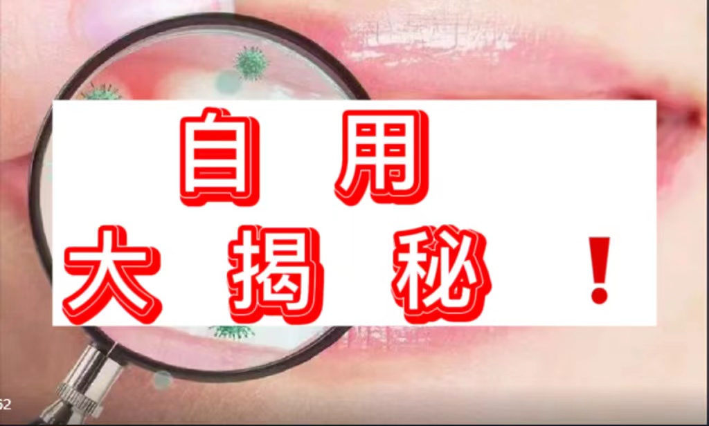 牙膏美白去黄去口臭牙渍正品爆款,公认去牙黄牙结石最好的牙膏