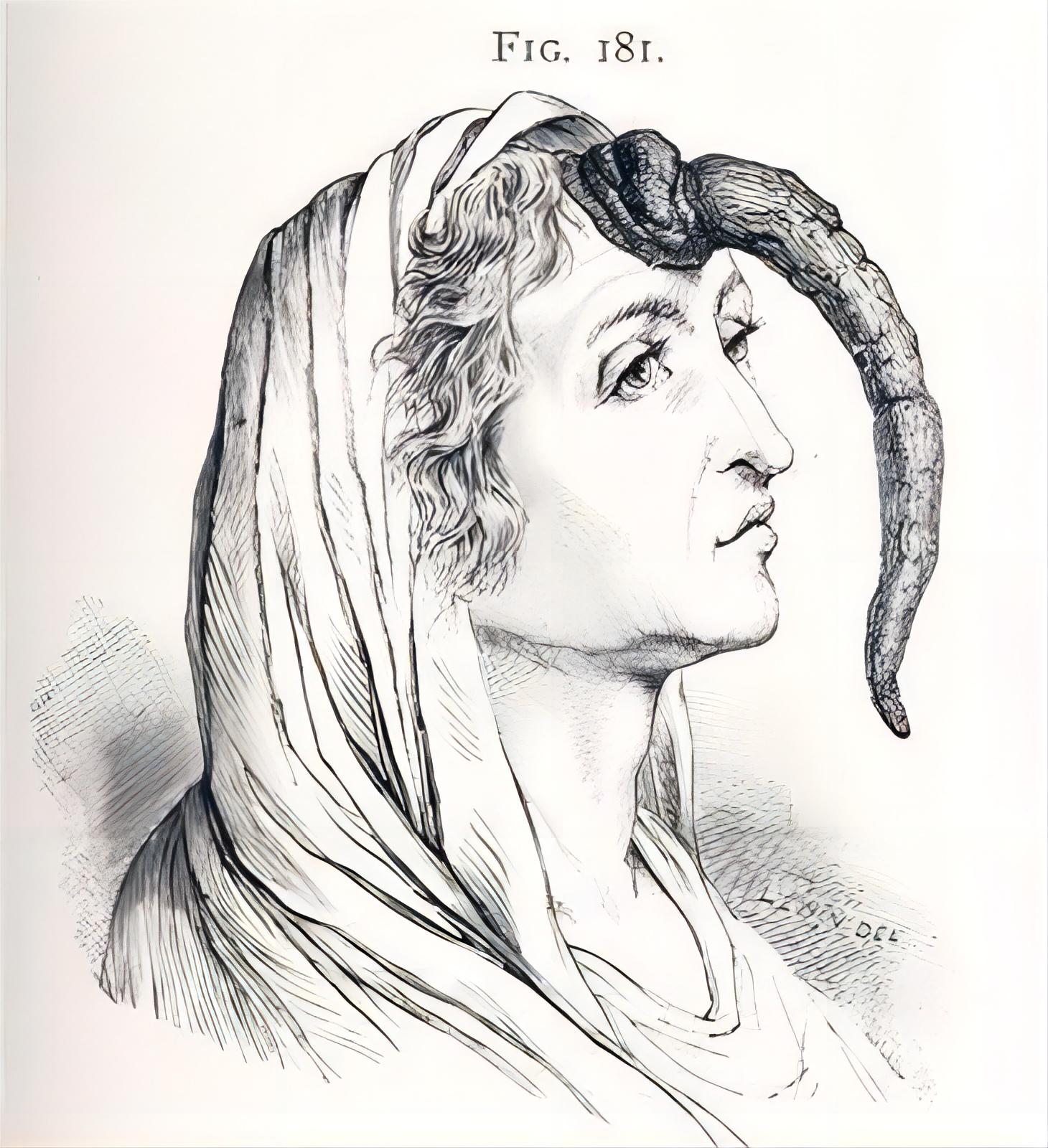 奇怪的“人角”：一段简短而令人不愉快的历史！