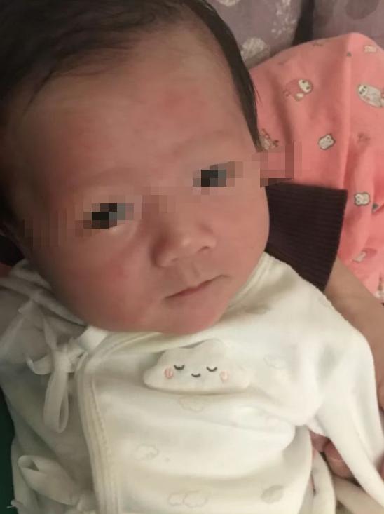 出生就查先天性甲减什么原因,刚出生一个月的孩子确诊甲减