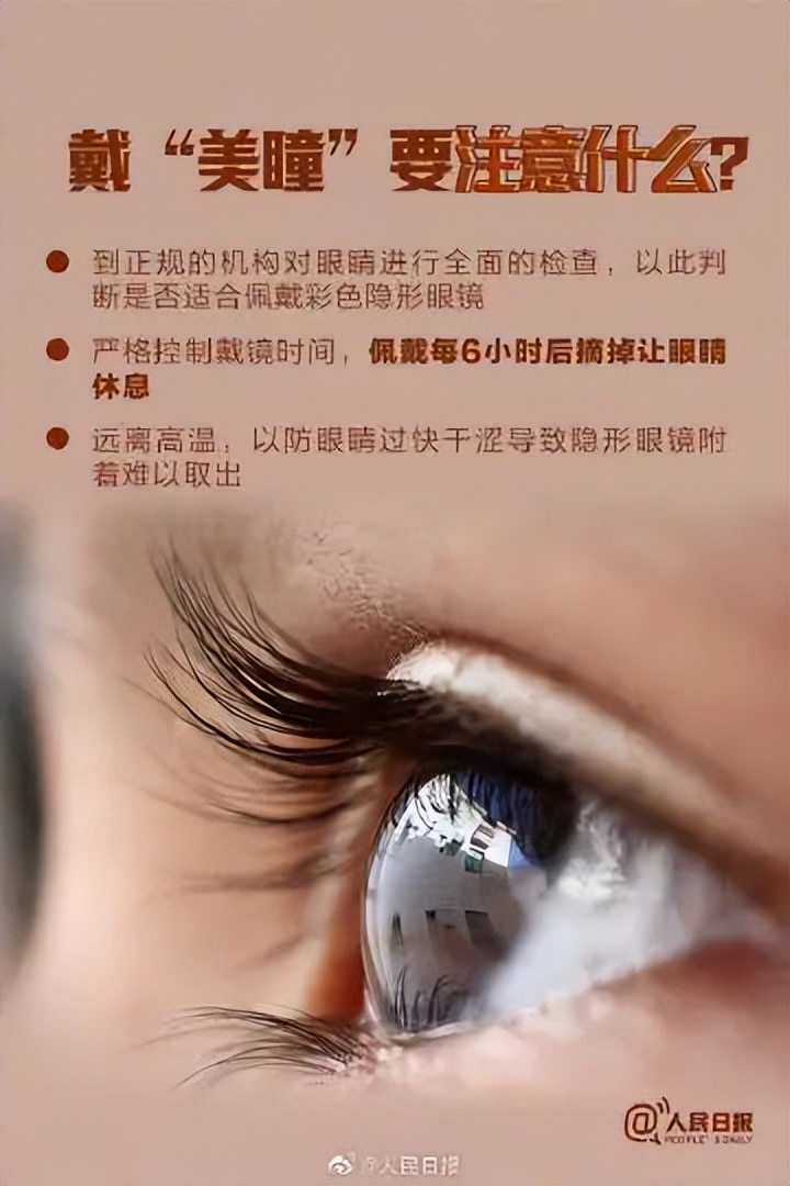 长期戴美瞳后果严重,戴美瞳会影响视网膜吗