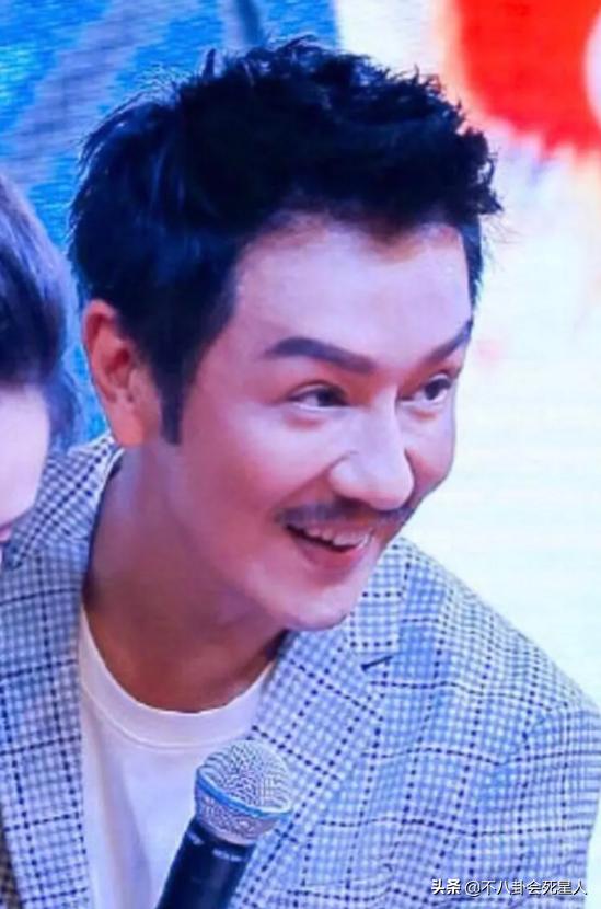 景甜悲伤蛙双眼皮照片,明星割双眼皮前后对比图