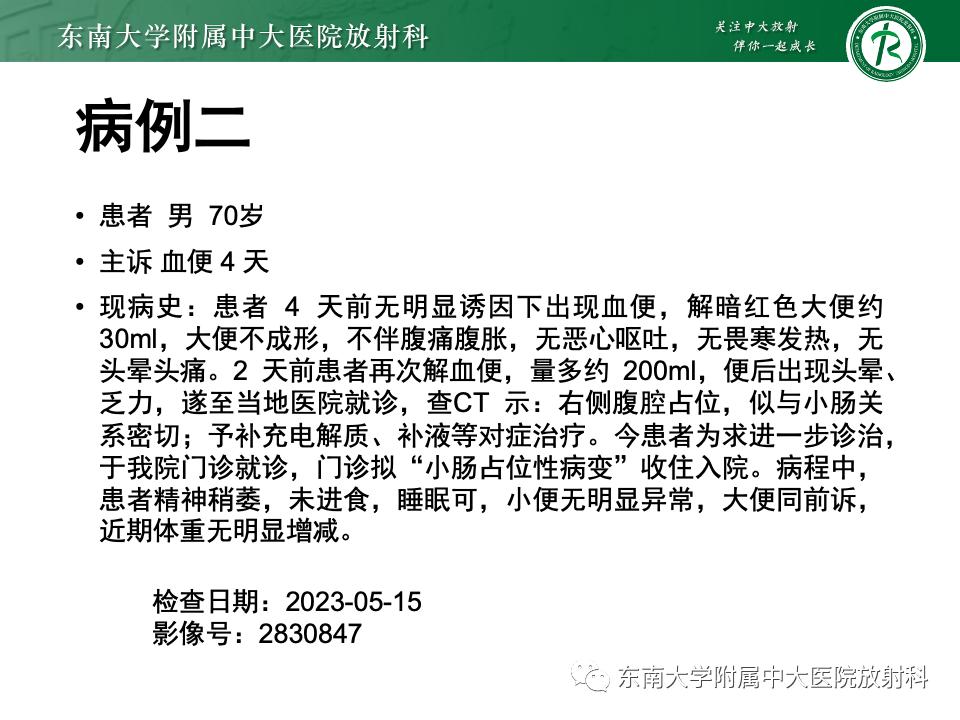 小肠间质瘤最新治疗中药方,小肠间质瘤基因检测