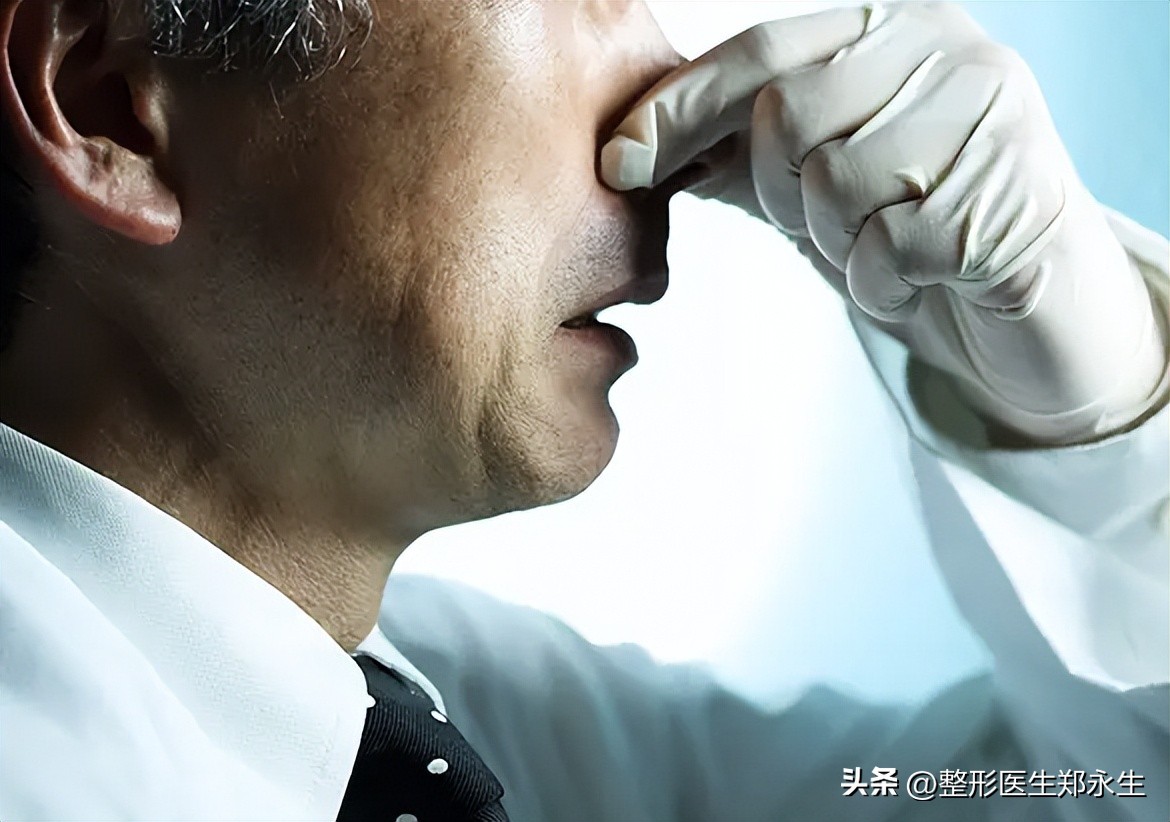 鼻中隔偏曲矫正三大误解：自我矫正、徒手正骨和吃药改善