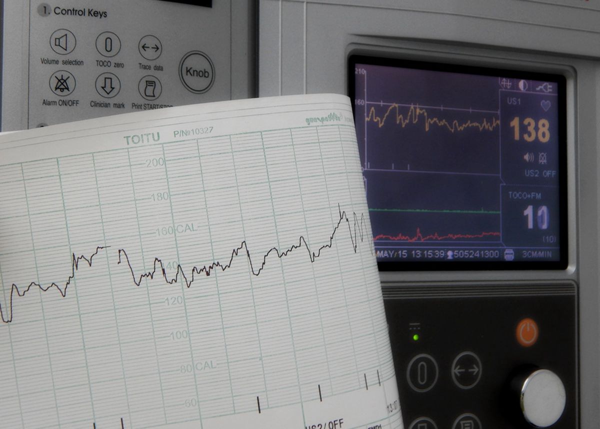 胎心辨别宝宝性格,通过胎心率可以判断宝宝的胎位