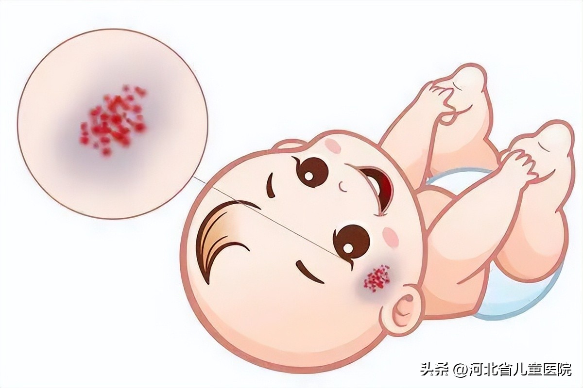 小孩脸上长满红点点是什么原因,孩子脸上长满了小黑点是怎么回事