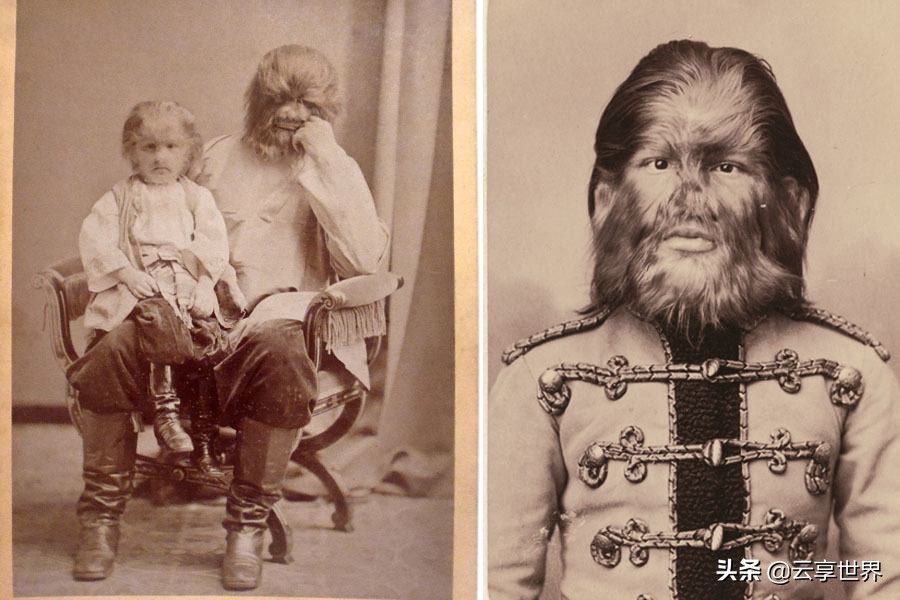 被歧视的异类群体，牟取暴利的工具，9位怪胎表演者的悲惨内幕