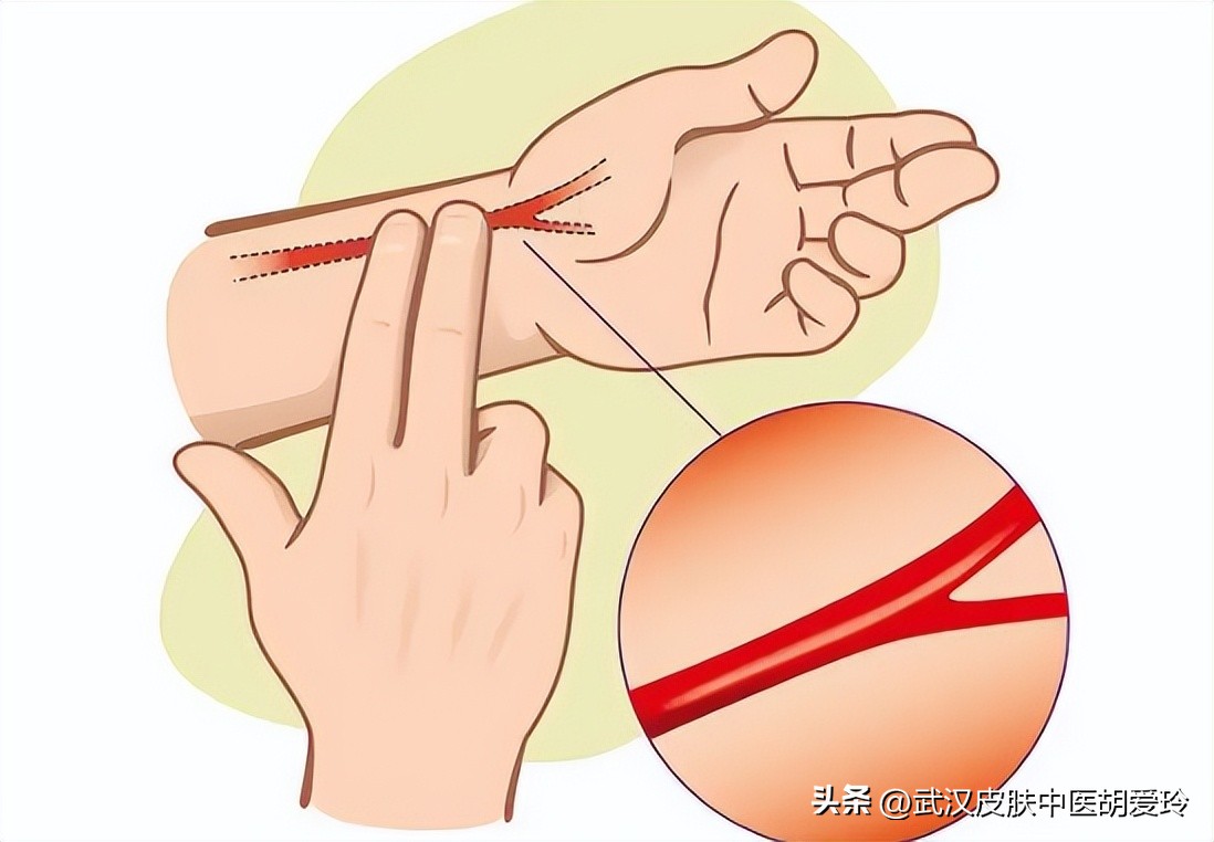 凸起小疙瘩痒是怎么回事,一片凸起的疙瘩很痒