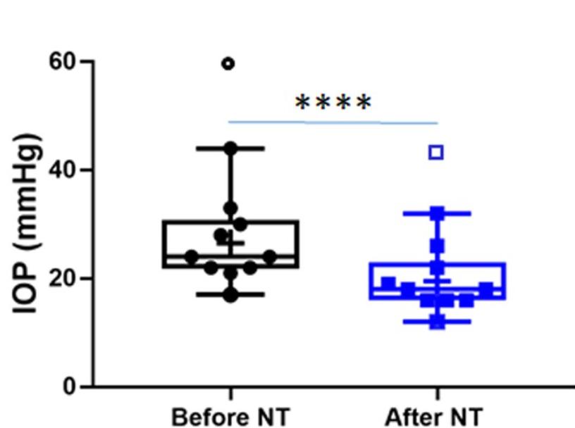 rho激酶抑制剂多少钱,rho激酶抑制剂是什么