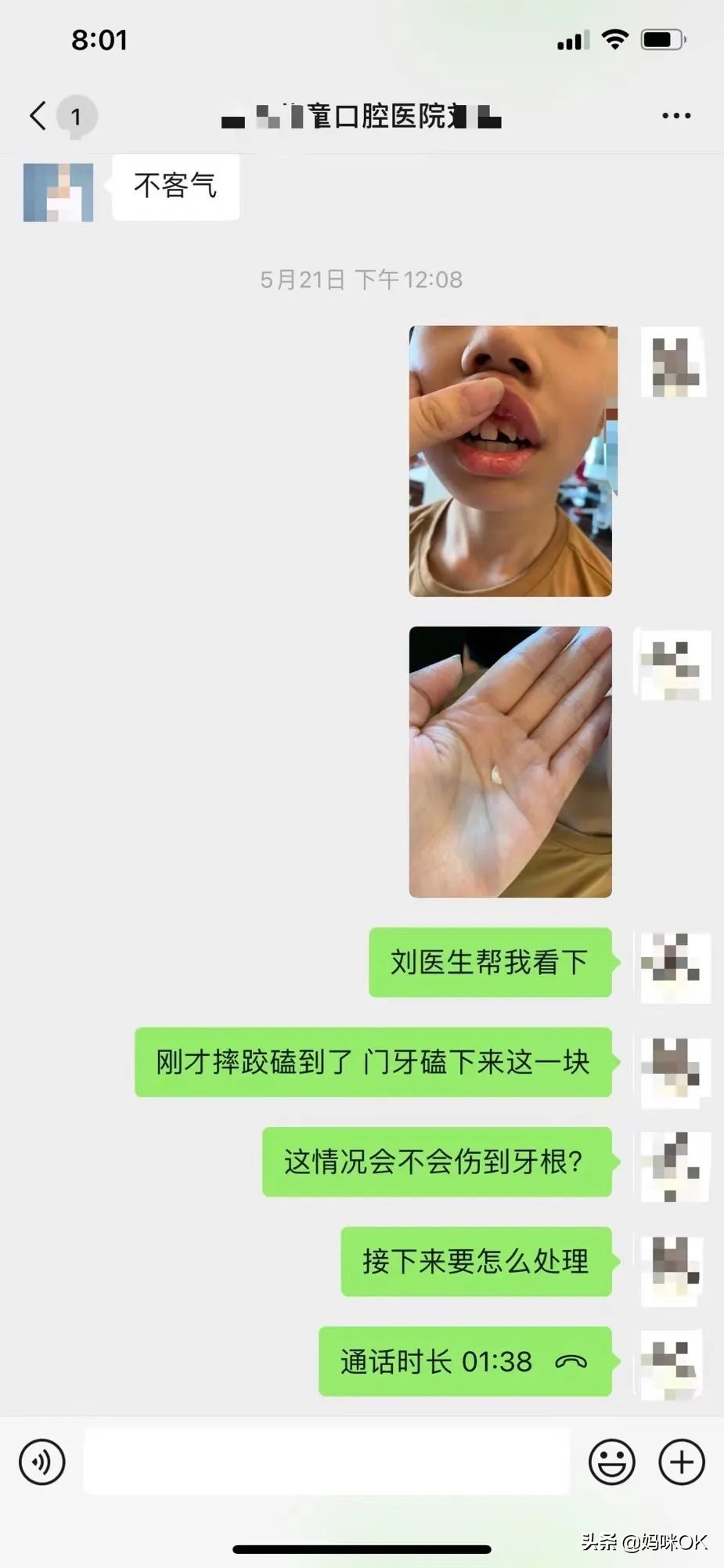 18岁前不能再用门牙吃东西！儿子的这一跤摔得有点惨痛