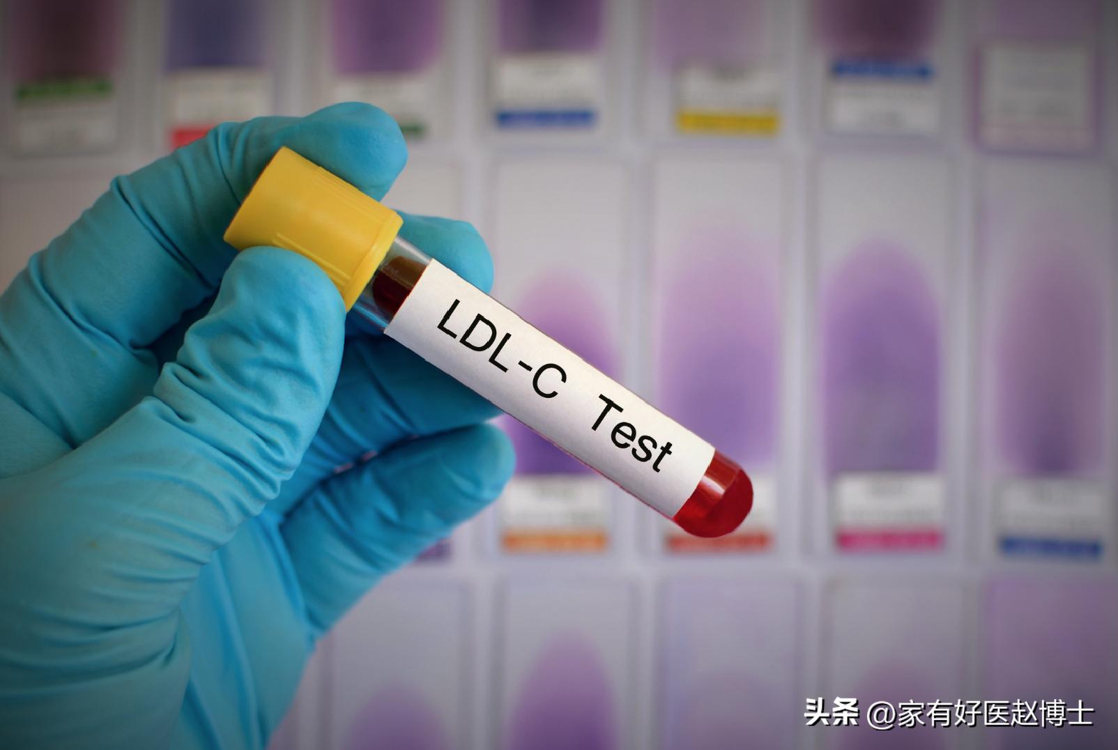 放了心脏支架如果支架坏了咋办,放了心脏支架为什么要抗凝血